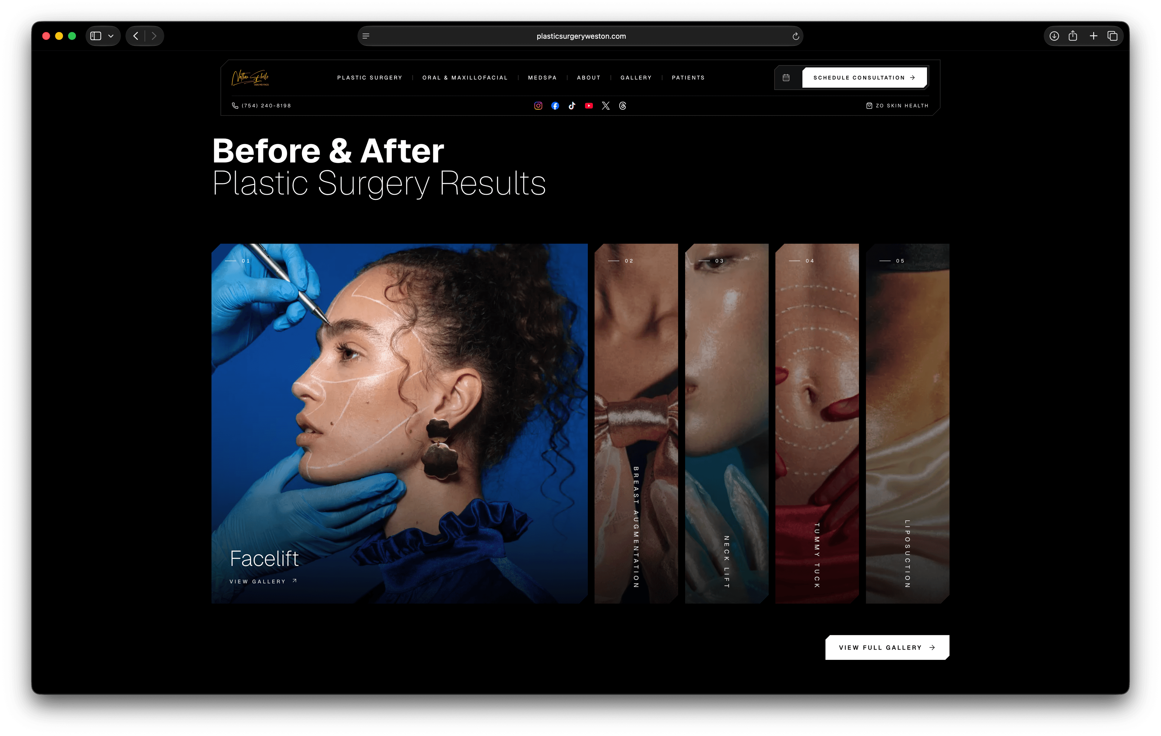 Weston Center for Plastic Surgery before and after gallery with a facelift feature and procedure columns